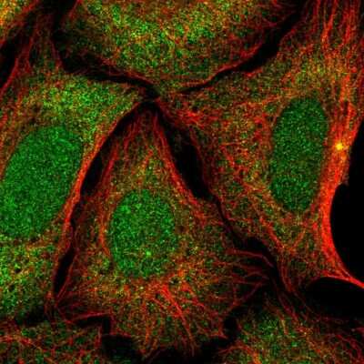 Immunocytochemistry/ Immunofluorescence: ZNF14 Antibody [NBP2-13552]