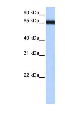 Western Blot: ZNF14 Antibody [NBP1-56337]