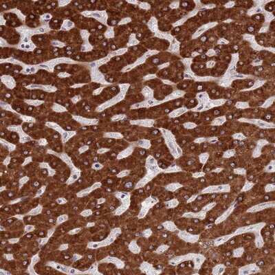 Immunohistochemistry-Paraffin: ZNF140 Antibody [NBP2-13553]