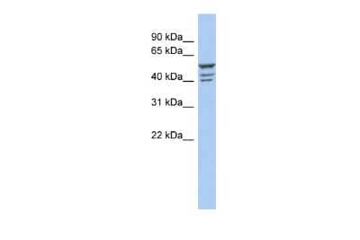 Western Blot: ZNF140 Antibody [NBP2-83824]