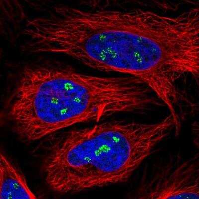 Immunocytochemistry/ Immunofluorescence: ZNF142 Antibody [NBP2-13554]