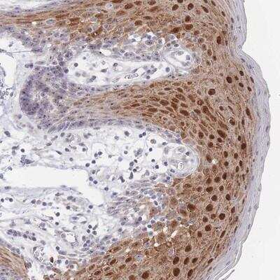 Immunohistochemistry-Paraffin: ZNF142 Antibody [NBP2-13554]