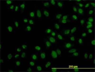 Immunocytochemistry/ Immunofluorescence: ZNF143 Antibody (2B4) [H00007702-M01]