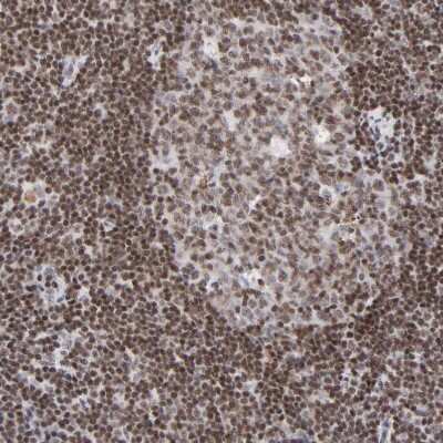 Immunohistochemistry-Paraffin: ZNF143 Antibody [NBP1-87278]
