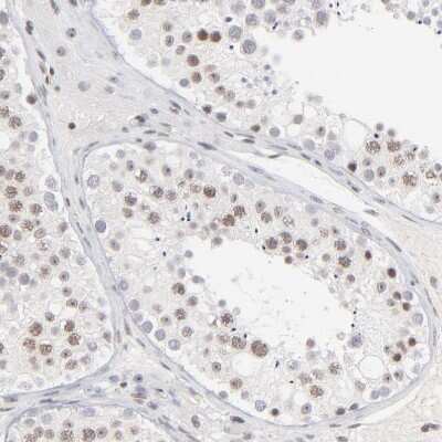 Immunohistochemistry-Paraffin: ZNF143 Antibody [NBP1-87278]