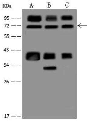 Western Blot: ZNF143 Antibody [NBP3-12663]