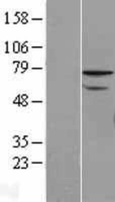 Western Blot: ZNF143 Overexpression Lysate [NBL1-18062]