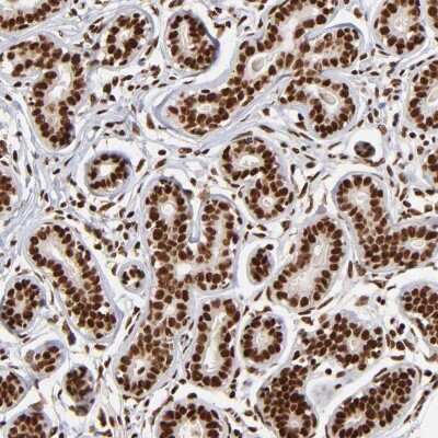 Immunohistochemistry-Paraffin: ZNF146 Antibody [NBP1-80968]