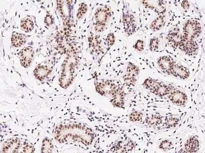 Immunohistochemistry-Paraffin: ZNF146 Antibody [NBP2-97822]