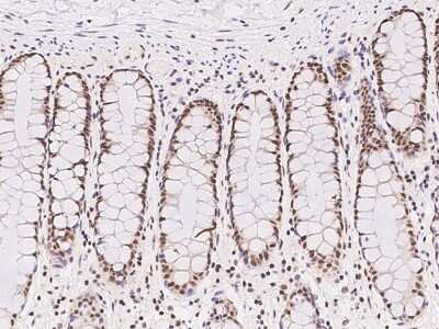 Immunohistochemistry-Paraffin: ZNF146 Antibody [NBP2-97822]