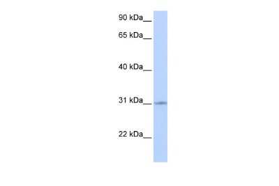 Western Blot: ZNF146 Antibody [NBP2-83827]