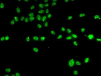 Immunocytochemistry/ Immunofluorescence: ZNF148 Antibody - BSA Free [NBP2-94521]