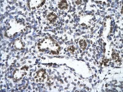 Immunohistochemistry-Paraffin: ZNF148 Antibody [NBP2-88646]