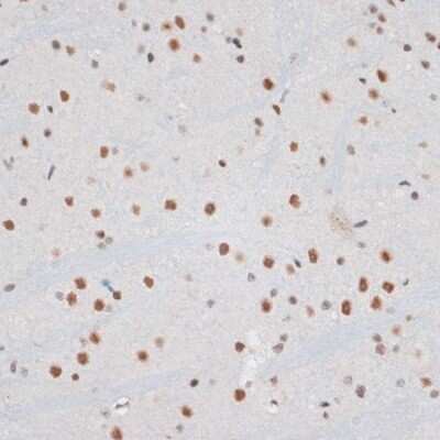 Immunohistochemistry-Paraffin: ZNF148 Antibody - BSA Free [NBP2-94521]