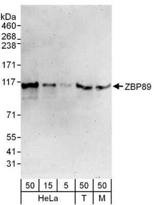 Western Blot: ZNF148 Antibody [NBP1-71872]