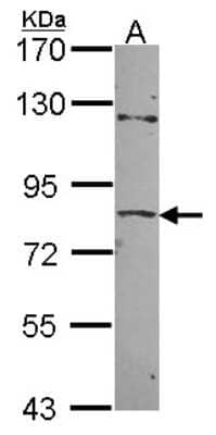 Western Blot: ZNF148 Antibody [NBP2-20964]