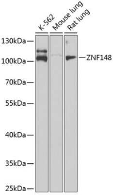 Western Blot: ZNF148 AntibodyBSA Free [NBP2-94521]