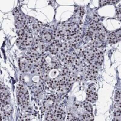 Immunohistochemistry-Paraffin: ZNF154 Antibody [NBP3-17563]