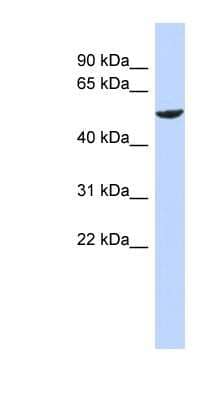 Western Blot: ZNF154 Antibody [NBP1-79273]