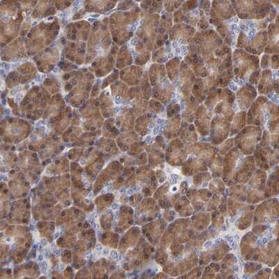 Immunohistochemistry-Paraffin: ZNF155 Antibody [NBP1-80912]
