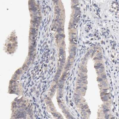 Immunohistochemistry-Paraffin: ZNF157 Antibody [NBP1-83130]