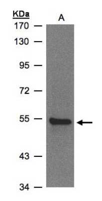 Western Blot: ZNF157 Antibody [NBP1-32389]