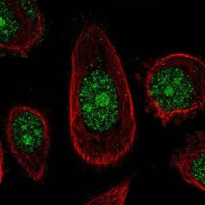 Immunocytochemistry/ Immunofluorescence: ZNF16 Antibody [NBP2-57416]