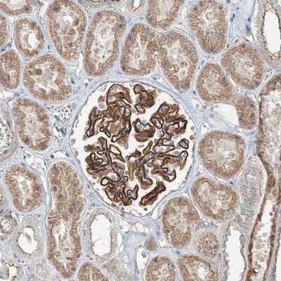 Immunohistochemistry-Paraffin: ZNF16 Antibody [NBP1-81343]