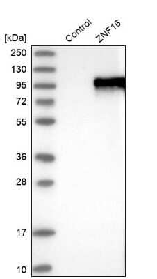 Western Blot: ZNF16 Antibody [NBP1-81343]