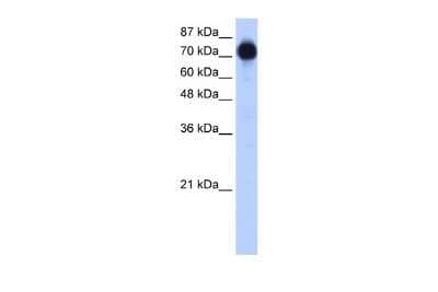 Western Blot: ZNF16 Antibody [NBP2-86440]