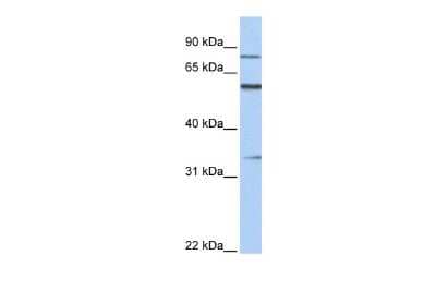 Western Blot: ZNF16 Antibody [NBP2-86441]