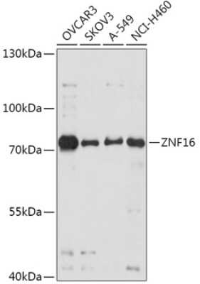 Western Blot: ZNF16 AntibodyAzide and BSA Free [NBP2-94230]