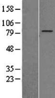 Western Blot: ZNF16 Overexpression Lysate [NBP2-08603]