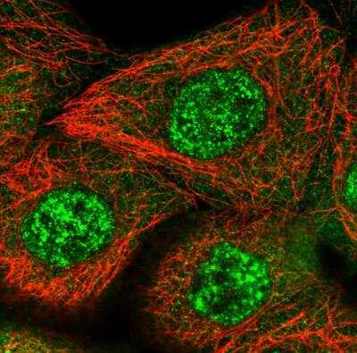 Immunocytochemistry/ Immunofluorescence: ZNF160 Antibody [NBP1-83939]