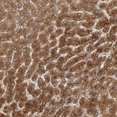 Immunohistochemistry-Paraffin: ZNF160 Antibody [NBP1-83939]