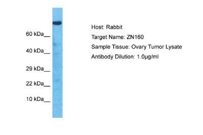 Western Blot: ZNF160 Antibody [NBP2-83829]