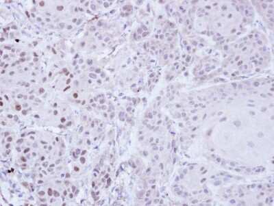 Immunohistochemistry-Paraffin: ZNF165 Antibody [NBP1-32507]