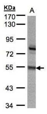 Western Blot: ZNF165 Antibody [NBP1-32507]