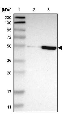 Western Blot: ZNF165 Antibody [NBP2-48507]