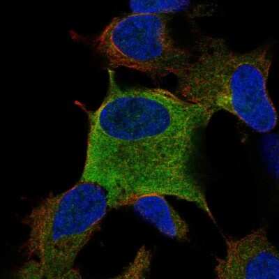 Immunocytochemistry/ Immunofluorescence: ZNF167 Antibody [NBP2-57863]
