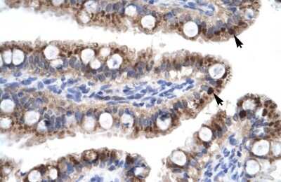 Immunohistochemistry: ZNF167 Antibody [NBP2-88648]