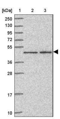 Western Blot: ZNF167 Antibody [NBP2-13555]