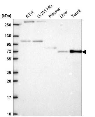 Western Blot: ZNF167 Antibody [NBP2-57863]