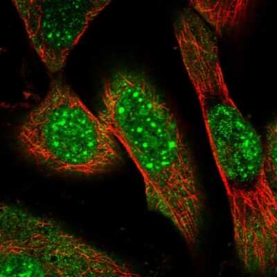 Immunocytochemistry/ Immunofluorescence: ZNF169 Antibody [NBP2-13556]