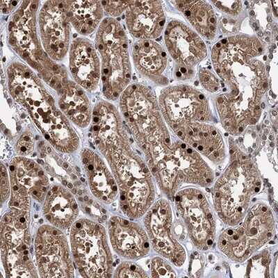 Immunohistochemistry-Paraffin: ZNF169 Antibody [NBP2-13556]