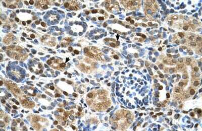 Immunohistochemistry-Paraffin: ZNF169 Antibody [NBP2-88649]