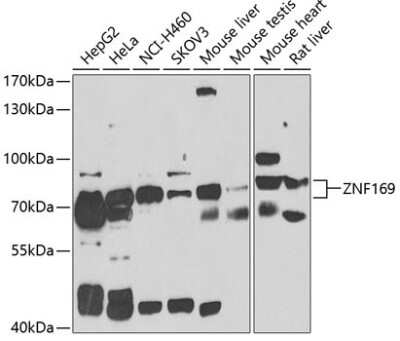 Western Blot: ZNF169 AntibodyBSA Free [NBP2-93206]