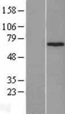 Western Blot: ZNF169 Overexpression Lysate [NBL1-18068]