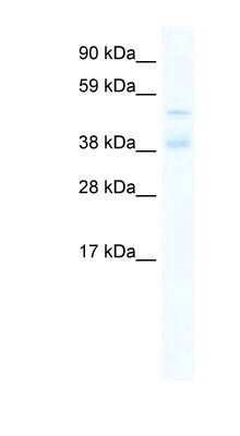 Western Blot: ZNF17 Antibody [NBP1-80203]