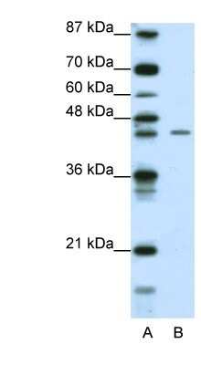 Western Blot: ZNF17 Antibody [NBP1-80317]